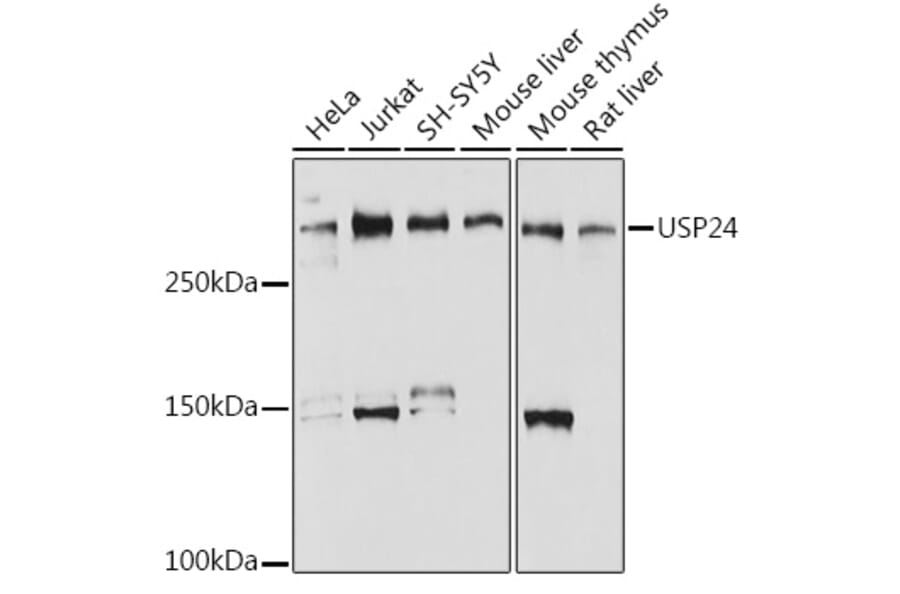 Western Blot - Anti-USP24 Antibody [ARC2526] (A309063) - Antibodies.com