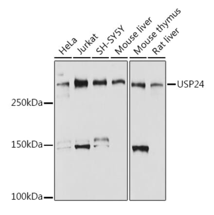 Western Blot - Anti-USP24 Antibody [ARC2526] (A309063) - Antibodies.com