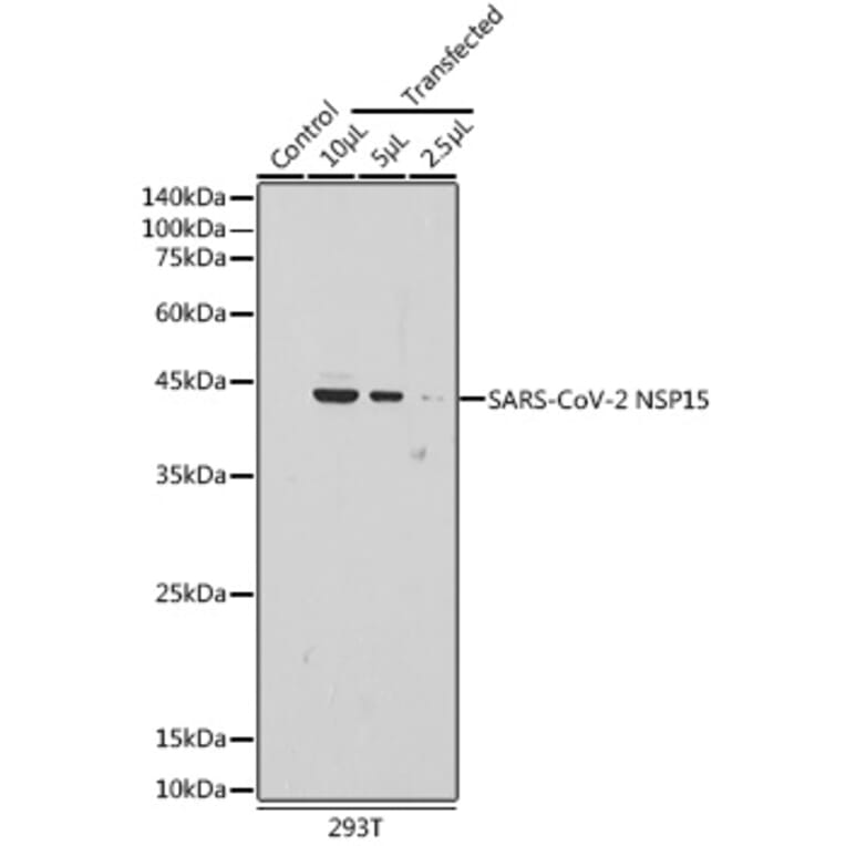Western Blot - Anti-SARS-CoV2 NSP15 Antibody (A309064) - Antibodies.com