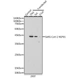 Western Blot - Anti-SARS-CoV2 NSP15 Antibody (A309064) - Antibodies.com
