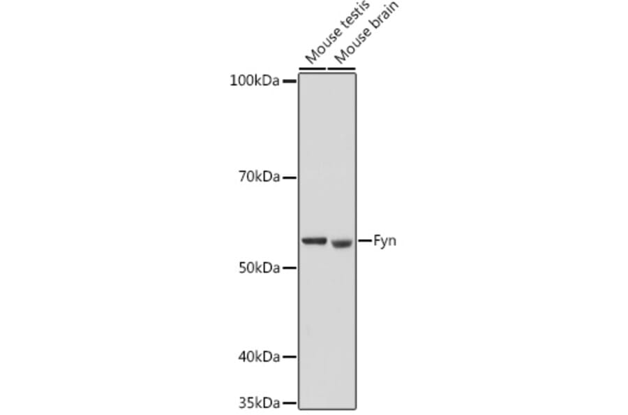 Western Blot - Anti-Fyn Antibody (A309065) - Antibodies.com