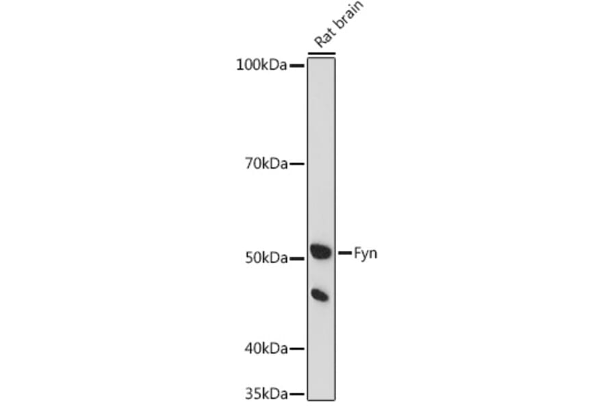 Western Blot - Anti-Fyn Antibody (A309065) - Antibodies.com