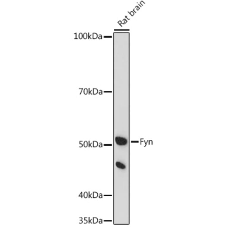 Western Blot - Anti-Fyn Antibody (A309065) - Antibodies.com