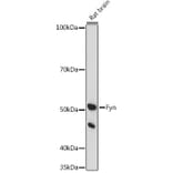 Western Blot - Anti-Fyn Antibody (A309065) - Antibodies.com