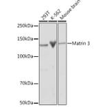 Western Blot - Anti-Matrin 3 Antibody [ARC1854] (A309066) - Antibodies.com