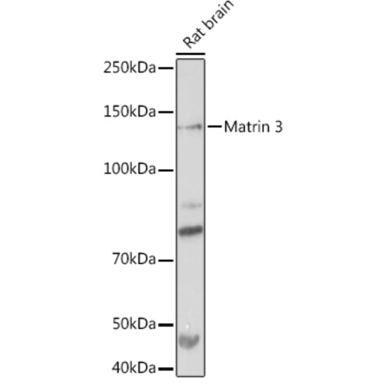 Western Blot - Anti-Matrin 3 Antibody [ARC1854] (A309066) - Antibodies.com