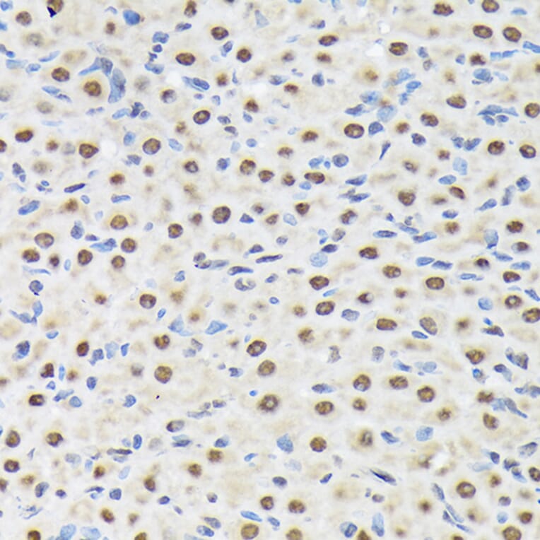 Immunohistochemistry - Anti-Matrin 3 Antibody [ARC1854] (A309066) - Antibodies.com