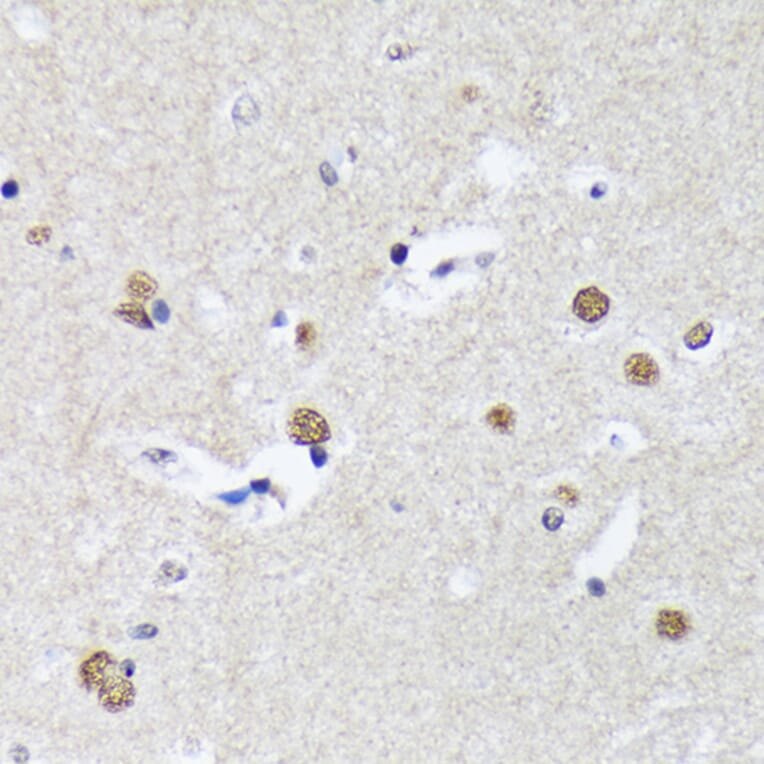 Immunohistochemistry - Anti-Matrin 3 Antibody [ARC1854] (A309066) - Antibodies.com