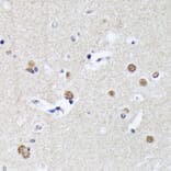 Immunohistochemistry - Anti-Matrin 3 Antibody [ARC1854] (A309066) - Antibodies.com