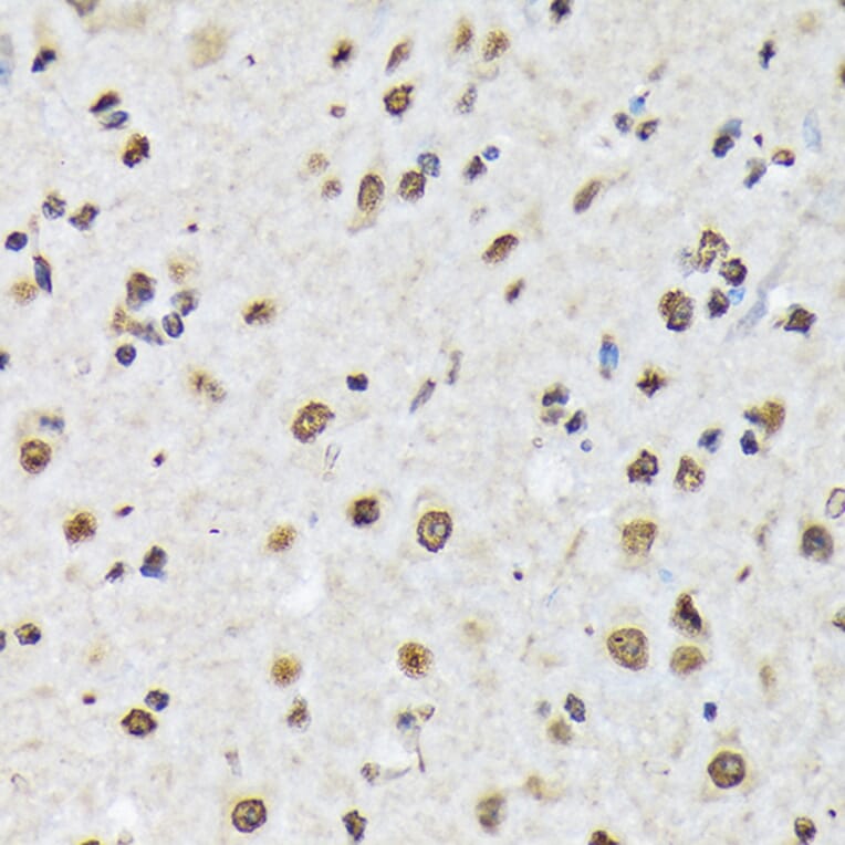 Immunohistochemistry - Anti-Matrin 3 Antibody [ARC1854] (A309066) - Antibodies.com