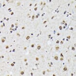 Immunohistochemistry - Anti-Matrin 3 Antibody [ARC1854] (A309066) - Antibodies.com