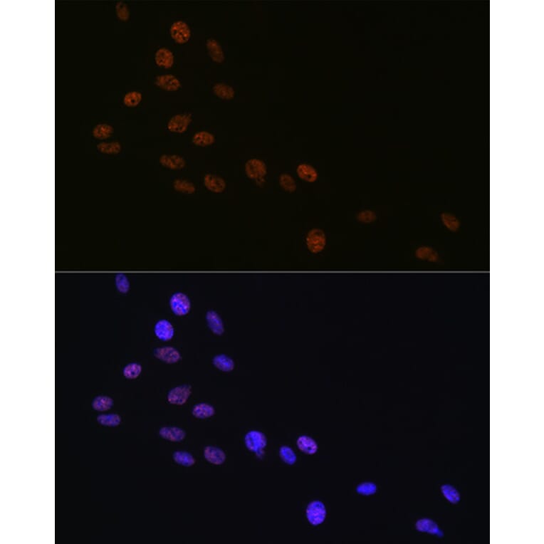 Immunofluorescence - Anti-Matrin 3 Antibody [ARC1854] (A309066) - Antibodies.com