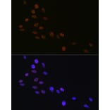 Immunofluorescence - Anti-Matrin 3 Antibody [ARC1854] (A309066) - Antibodies.com