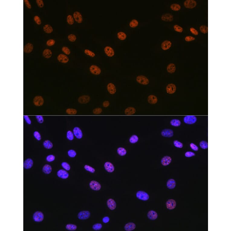 Immunofluorescence - Anti-Matrin 3 Antibody [ARC1854] (A309066) - Antibodies.com