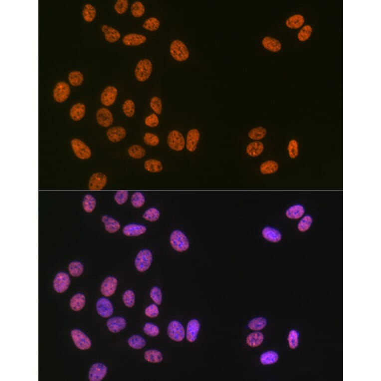 Immunofluorescence - Anti-Matrin 3 Antibody [ARC1854] (A309066) - Antibodies.com