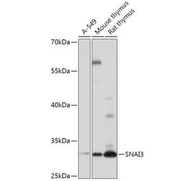 Western Blot - Anti-SNAI3 Antibody (A309067) - Antibodies.com