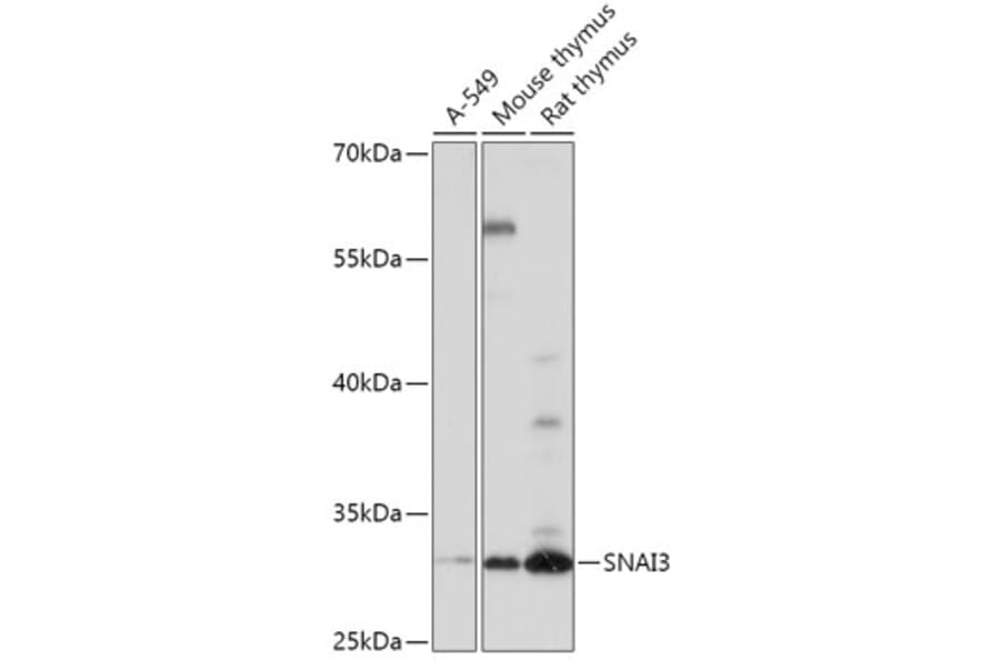Western Blot - Anti-SNAI3 Antibody (A309067) - Antibodies.com