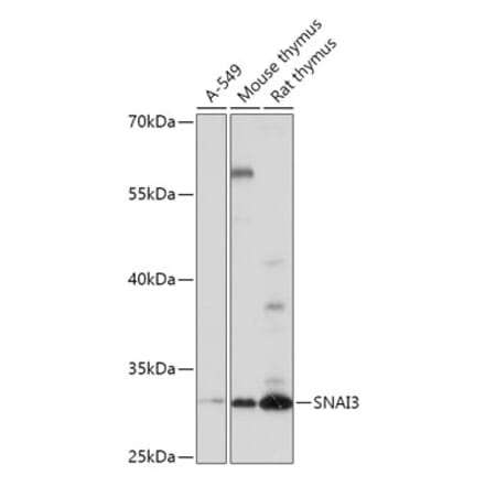 Western Blot - Anti-SNAI3 Antibody (A309067) - Antibodies.com