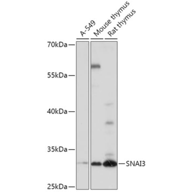 Western Blot - Anti-SNAI3 Antibody (A309067) - Antibodies.com