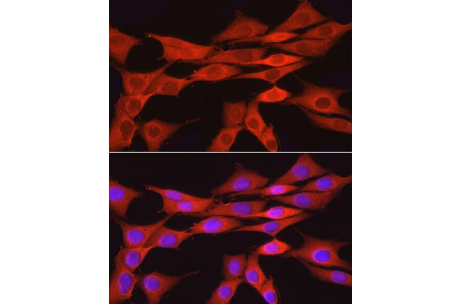 Immunofluorescence - Anti-GAPDH Antibody [ARC50888] (A309068) - Antibodies.com