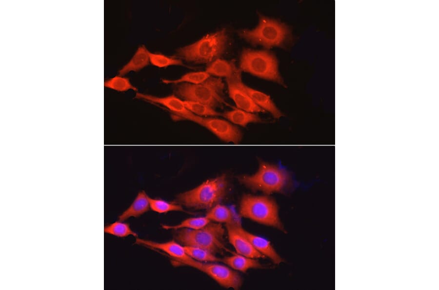 Immunofluorescence - Anti-GAPDH Antibody [ARC50888] (A309068) - Antibodies.com