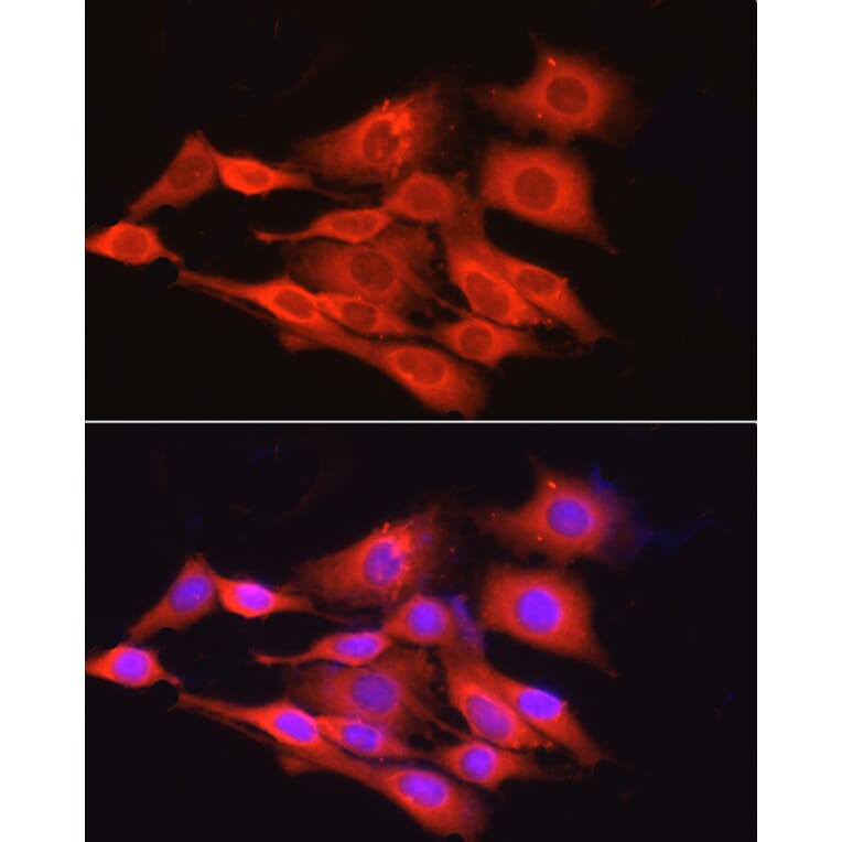 Immunofluorescence - Anti-GAPDH Antibody [ARC50888] (A309068) - Antibodies.com