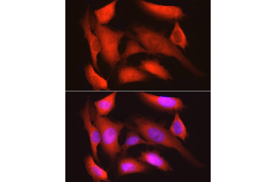 Immunofluorescence - Anti-GAPDH Antibody [ARC50888] (A309068) - Antibodies.com