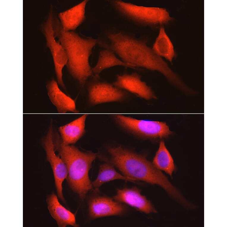Immunofluorescence - Anti-GAPDH Antibody [ARC50888] (A309068) - Antibodies.com