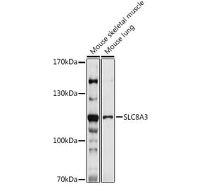 Western Blot - Anti-SLC8A3 Antibody (A309069) - Antibodies.com