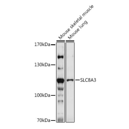 Western Blot - Anti-SLC8A3 Antibody (A309069) - Antibodies.com
