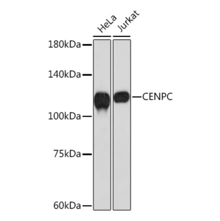 Western Blot - Anti-CENPC Antibody [ARC2097] (A309070) - Antibodies.com