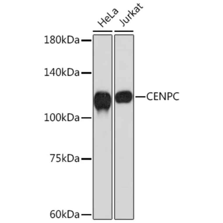 Western Blot - Anti-CENPC Antibody [ARC2097] (A309070) - Antibodies.com