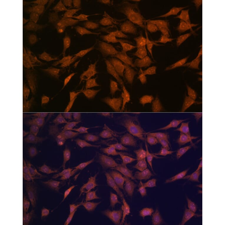 Immunofluorescence - Anti-CENPC Antibody [ARC2097] (A309070) - Antibodies.com