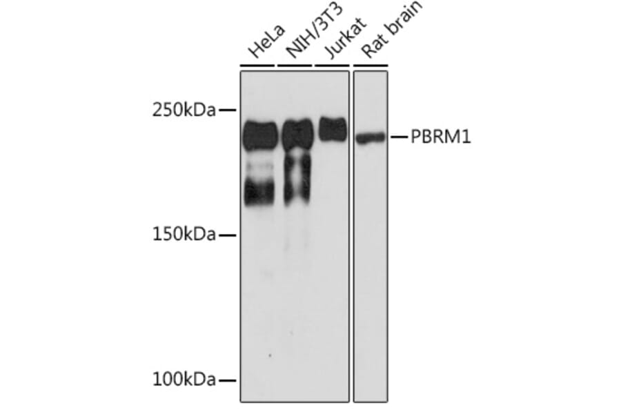 Western Blot - Anti-Baf180 Antibody [ARC1820] (A309071) - Antibodies.com