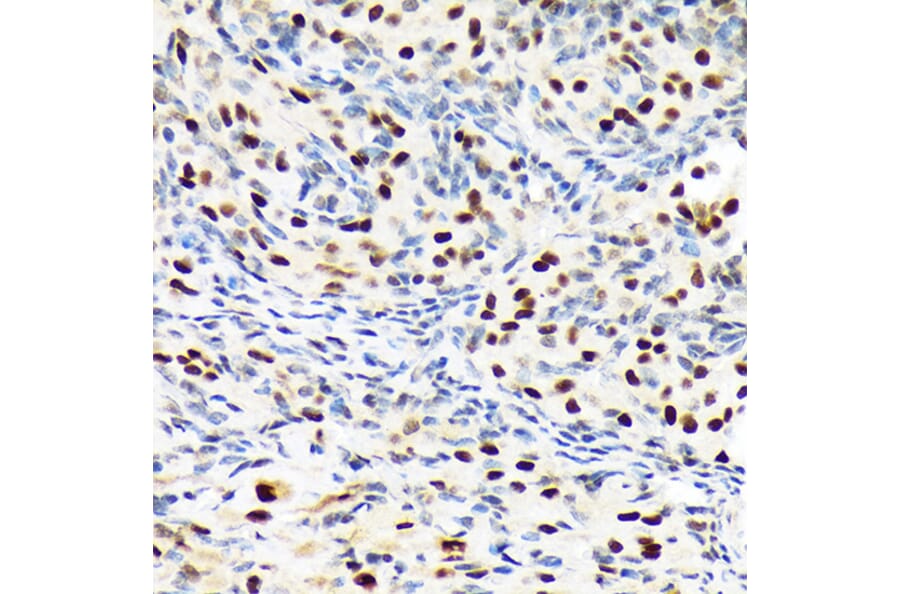Immunohistochemistry - Anti-Baf180 Antibody [ARC1820] (A309071) - Antibodies.com