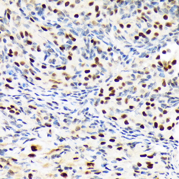 Immunohistochemistry - Anti-Baf180 Antibody [ARC1820] (A309071) - Antibodies.com