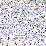 Immunohistochemistry - Anti-Baf180 Antibody [ARC1820] (A309071) - Antibodies.com