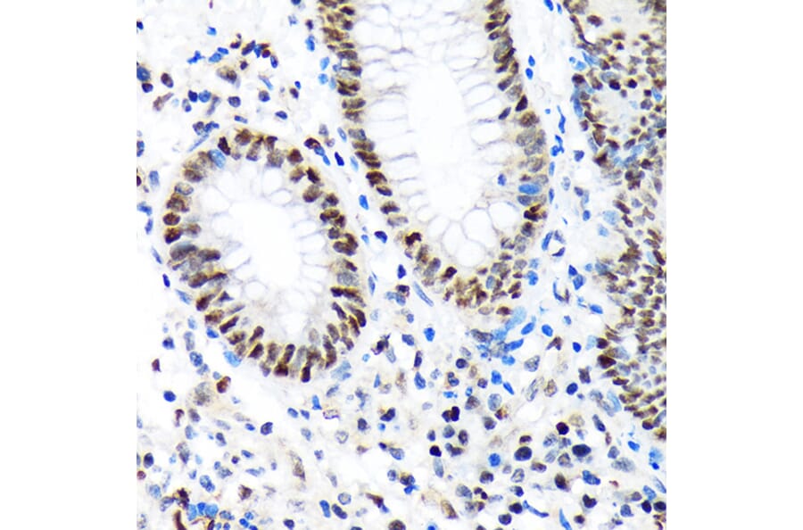 Immunohistochemistry - Anti-Baf180 Antibody [ARC1820] (A309071) - Antibodies.com