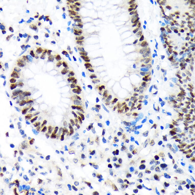 Immunohistochemistry - Anti-Baf180 Antibody [ARC1820] (A309071) - Antibodies.com
