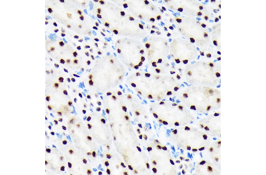 Immunohistochemistry - Anti-Baf180 Antibody [ARC1820] (A309071) - Antibodies.com