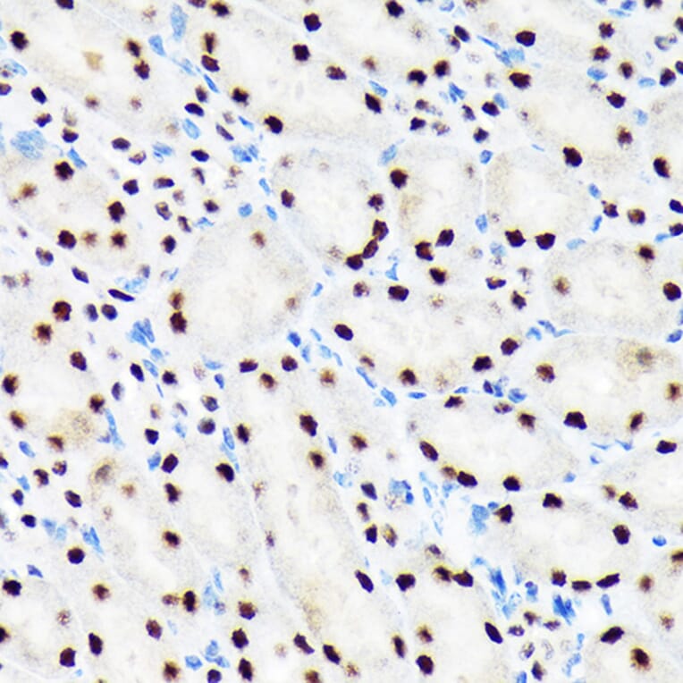 Immunohistochemistry - Anti-Baf180 Antibody [ARC1820] (A309071) - Antibodies.com
