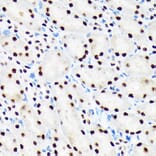 Immunohistochemistry - Anti-Baf180 Antibody [ARC1820] (A309071) - Antibodies.com