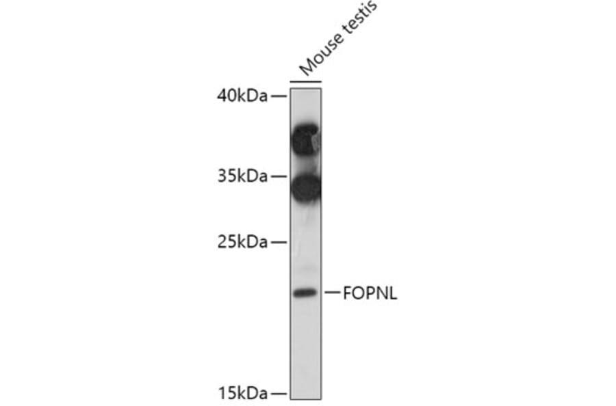 Western Blot - Anti-FOPNL Antibody (A309072) - Antibodies.com
