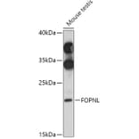 Western Blot - Anti-FOPNL Antibody (A309072) - Antibodies.com