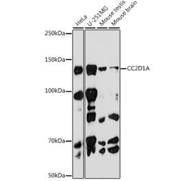 Western Blot - Anti-CC2D1A Antibody [ARC2464] (A309073) - Antibodies.com