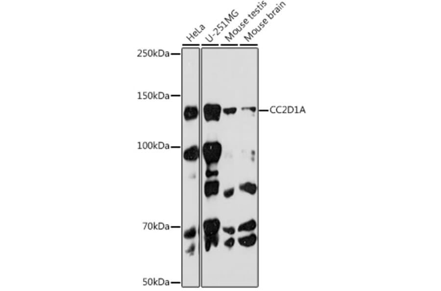 Western Blot - Anti-CC2D1A Antibody [ARC2464] (A309073) - Antibodies.com