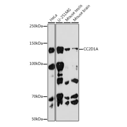 Western Blot - Anti-CC2D1A Antibody [ARC2464] (A309073) - Antibodies.com