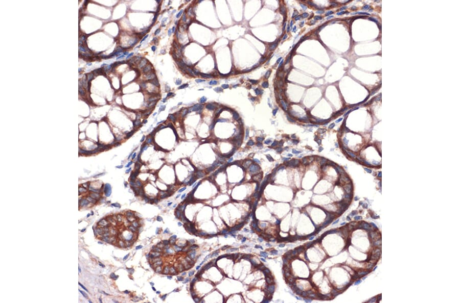 Immunohistochemistry - Anti-CC2D1A Antibody [ARC2464] (A309073) - Antibodies.com