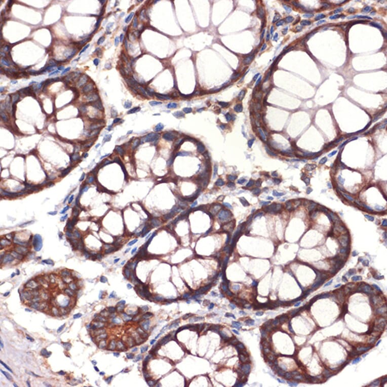 Immunohistochemistry - Anti-CC2D1A Antibody [ARC2464] (A309073) - Antibodies.com