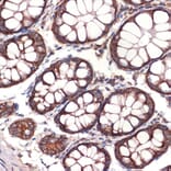 Immunohistochemistry - Anti-CC2D1A Antibody [ARC2464] (A309073) - Antibodies.com